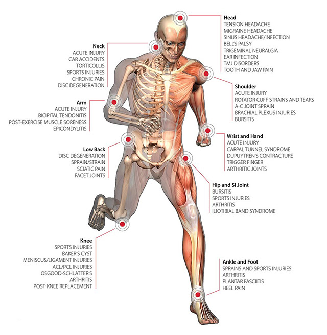 Diagram of the human body highlighting common pain points and injury areas